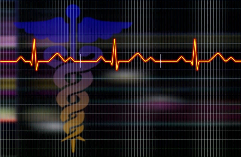 CardioID vyvíjí v Brně originální biometrické ověření identity založené na EKG